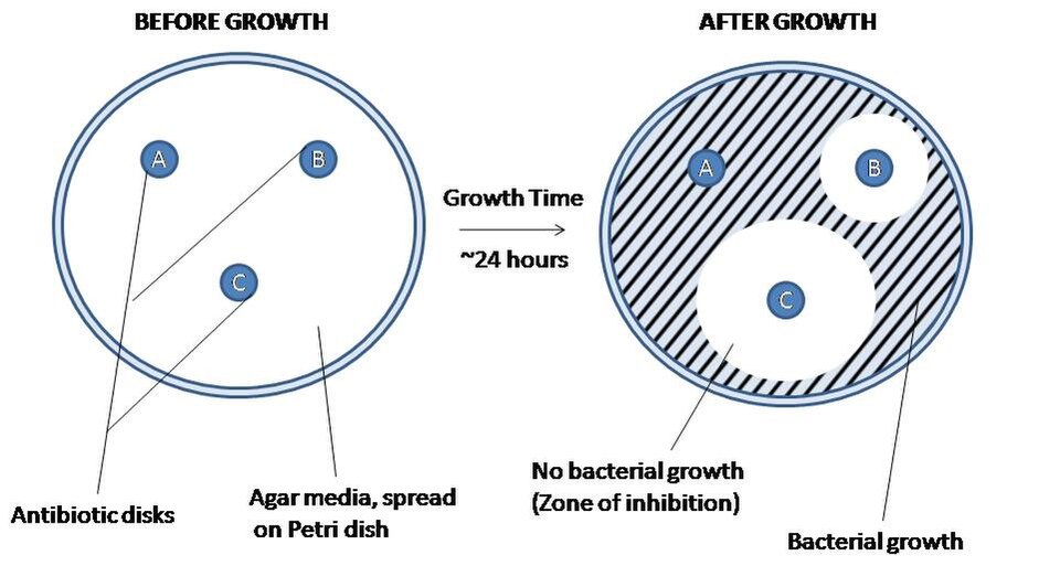 An agar plate showing zones of inhibition around antibiotic discs, a visible diffusion gradient